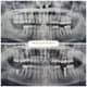 Slider image (9) Adaport Dental Clinic